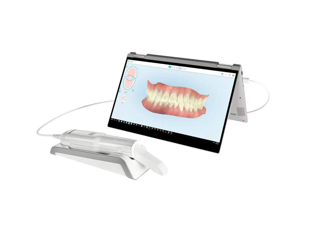iTero® Intraoral Scanner iTero® Intraoral Scanner